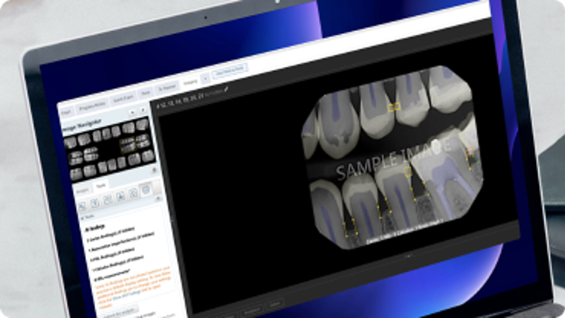 Dentrix Ascend Dental Practice Management Software Henry Schein One